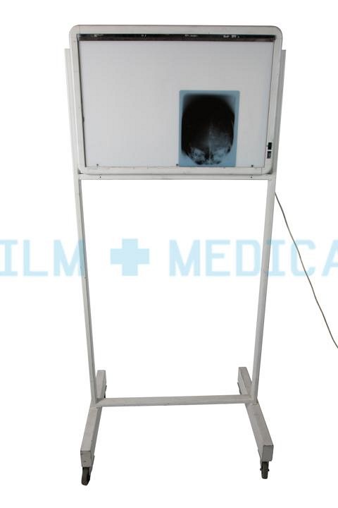 X Ray Lightbox Double Freestanding ( X Ray not Included)